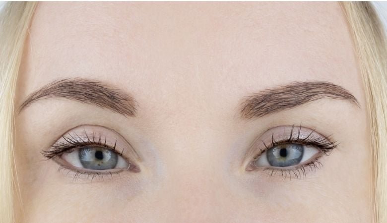 Injektiohoito Fox Eyes - silmäkulmien kohotus (2-4 lankaa) | -51 % | Tampere - Injektiohoito Fox Eyes - silmäkulmien kohotus lankaa