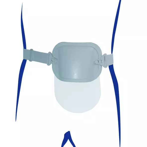 StomaCare ProtectorMax avannesuoja